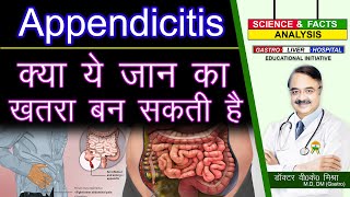 क्या ये जान का ख़तरा बन सकती है  APPENDICITIS FACTS [upl. by Micah]