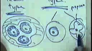 SYSTEMIC PATHOLOGY anaemia and lymphoma DR SAMEH GHAZY [upl. by Nawek]