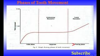 PHASES OF TOOTH MOVEMENT AFTER APPLYING ORTHODONTIC FORCE EXPLAINED ORTHODONTICS [upl. by Dasi]