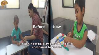 Congenital Muscular Dystrophy New Treatment Results  Quick Look  No 3124 [upl. by Ahar]