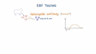 Epstein Barr Virus EBV Diagnosis and Testing [upl. by Rosalee]