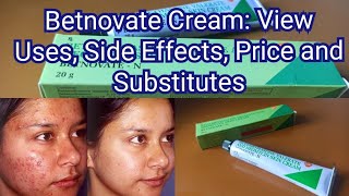 Betnovate Cream  Review Uses and Side EffectsPriceSubstitutes Availability in Tamil  How to Use [upl. by Ocnarfnaig]