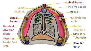 ANATOMICAL LANDMARKS OF MAXILLARY ARCH  MAXILLA  PROSTHODONTICS  DENTAL OCCLUSION [upl. by Irving277]