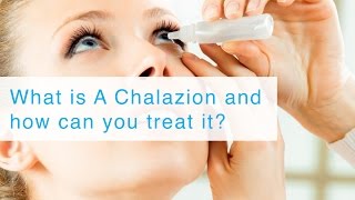 What is A Chalazion and how can you treat it [upl. by Janos]