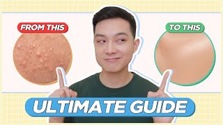 ULTIMATE GUIDE to Treat amp Prevent BLACKHEADS WHITEHEADS TINY BUMPS for FILIPINO SKIN  Jan Angelo [upl. by Ibbie]