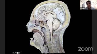 Microsurgical Anatomy of the Subarachnoid Cisterns [upl. by Mcnair]