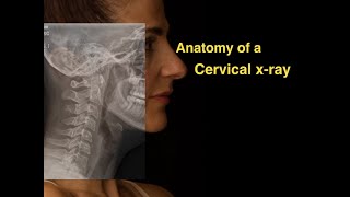 Anatomy of a Cervical xray [upl. by Gaultiero]