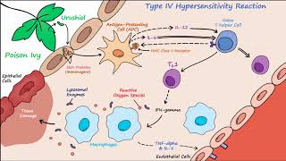 Type IV Hypersensitivity Described Concisely [upl. by Diandra83]