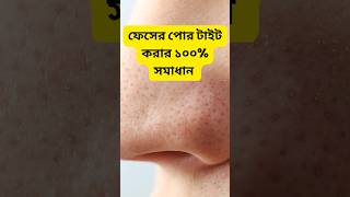 ফেসের পোর টাইট করার ১০০ সমাধান  How to tight your face pores Kaise tight karu faceka pores [upl. by Halle]