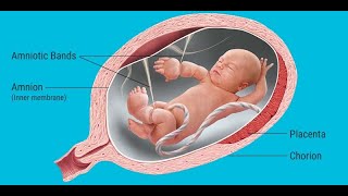 Amniotic fluid sources amniocentesis oligohydramnios polyhydramnios amniotic band syndrome [upl. by Gnes68]