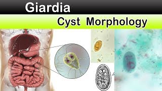 Giardia Cyst Morphology [upl. by Eniamzaj]