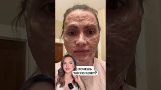 ❌ЗОМБИ МАСКА ОТ ЧЕРНЫХ ТОЧЕК И МОРЩИН😱маскаотморщин маскаотпрыщей маскадлялица кремдлялица [upl. by Kennard104]