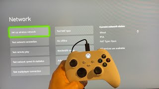 Xbox Series XS How to Fix Xbox Network Disconnecting Tutorial Boost Internet Speeds amp Reduce Lag [upl. by Earised]