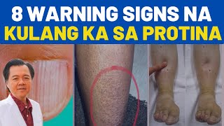 8 Warning Signs ng Kulang sa Protina  Payo ni Doc Willie Ong [upl. by Yeldahc349]