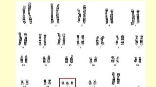 AS level E1 Chromosomes and the cell cycle Ms Cooper [upl. by Pendleton]