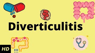 Diverticulitis Causes SIgns and Symptoms Diagnosis and Treatment [upl. by Malamut]