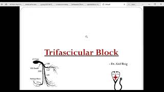 Trifascicular block Dr Akif Baig [upl. by Einnahpets211]