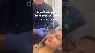 Anesthésie par le froid avant injections des cernes medecineesthetique cernes acidehyaluronique [upl. by Assiron182]