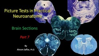 Picture Test in Neuroanatomy Brain Sections 7 [upl. by Ivets]