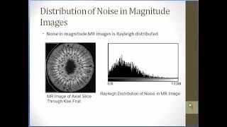 MRI Basics Course Module 10 Topic 1 Signal Contrast and Noise [upl. by Eytak]