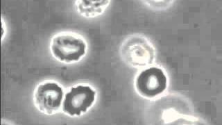 Blood in Hypertonic Solution produces crenated cells [upl. by Marcelline558]