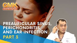 Preauricular Sinus Perichondritis and Ear Infection Part 3  Usapang Pangkalusugan [upl. by Ientirb]