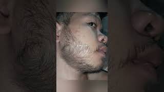 Kirkland Minoxidil Beard Journey 4 MONTH TRANSFORMATION [upl. by Bach]