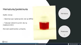 UT10  Hematuria proteinuria [upl. by Cerys]