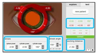 Retinoscopy Simulator Practice Retinoscopy with Simulator [upl. by Enram]