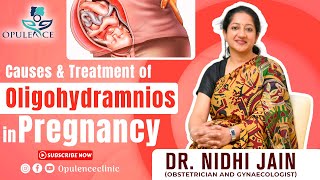 Prevention amp Treatment of Oligohydramnios  प्रेगनेंसी में एमनीओटिक फ्लूइड कम होना  Dr Nidhi Jain [upl. by Trutko]