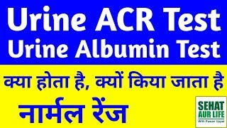 Urine ACR Test in Hindi Urine Albumin Test In Hindi Urine Albumin Normal Range [upl. by Feldstein]