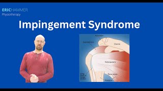 Impingement Syndrome [upl. by Terb]