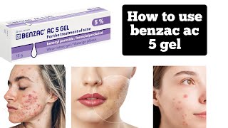 Benzac Ac benzole peroxide 50 mg active acne treatmentshrink open poresclean dark spot [upl. by Allveta]