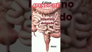 APENDICITE CAUSAS SINTOMAS TRATAMENTO [upl. by Attenyt924]