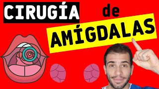 ✅ Cirugía de amígdalas AMIGDALECTOMÍA 👄 ¿Cuáles son los riesgos y complicaciones [upl. by Marta]