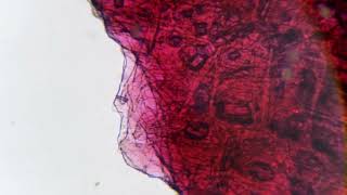 Red Onion  What Does It Look Like  Microscope [upl. by Rialc]