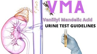 VMA Detection  Urine Testits simple 😱😱MLTTUTELAGERequested topic [upl. by Margette]