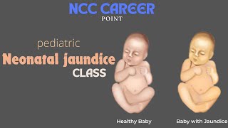 Pediatric Neonatal Jaundice class  2024 [upl. by Hansen]