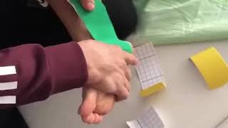 Sprain ankle taping  Eversion sprain [upl. by Dehlia145]