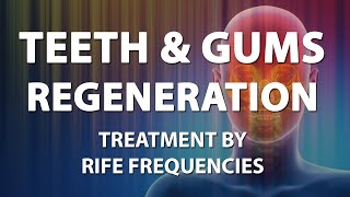 Teeth and Gums Regeneration Tooth  RIFE Frequencies Treatment  Energy amp Quantum Medicine [upl. by Roxanna]