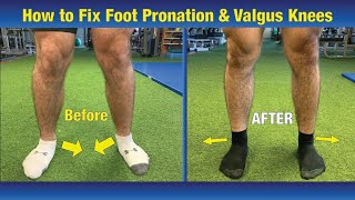 VERY EFFECTIVE Way to FIX Pronated feet amp Knees Caving In Valgus Knees [upl. by Granger]