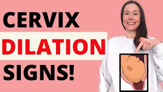 CERVIX DILATION SYMPTOMS  WHAT DOES CERVICAL DILATION FEEL LIKE AND HOW TO TELL IF YOU ARE DILATED [upl. by Erick]