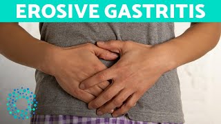 EROSIVE GASTRITIS  Belly Pain And Vomiting [upl. by Eneloc142]