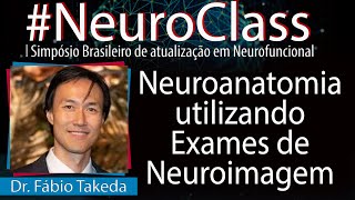 Neuroanatomia utilizando Exames de Neuroimagem  Dr Fábio Takeda [upl. by Ciccia233]