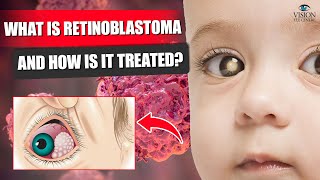 What is Retinoblastoma and How is it treated  Retinoblastoma Treatment [upl. by Idnahs904]