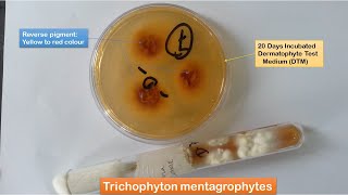 Ringworm causing Dermatophytes KOH mount Culture LPCB Preparation and Urease test [upl. by Ahsienyt]