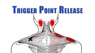 Trigger Point Release  Upper Trapezius Levator Scapulae and Suboccipitals  No Tools Needed [upl. by Anayia455]