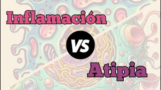 Inflamación versus atipia celular [upl. by Eddana]