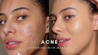 HOW TO COVER ACNE WITH MAKEUP BASE ROUTINE [upl. by Vadim898]