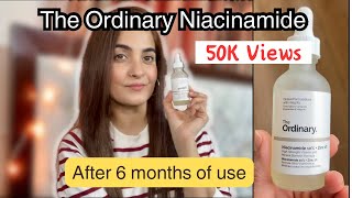 The Ordinary Niacinamide 10  zinc 1 Review WHAT ARE THE RESULTS after 6 months of USE [upl. by Novello]